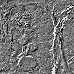 Confocal - DIC