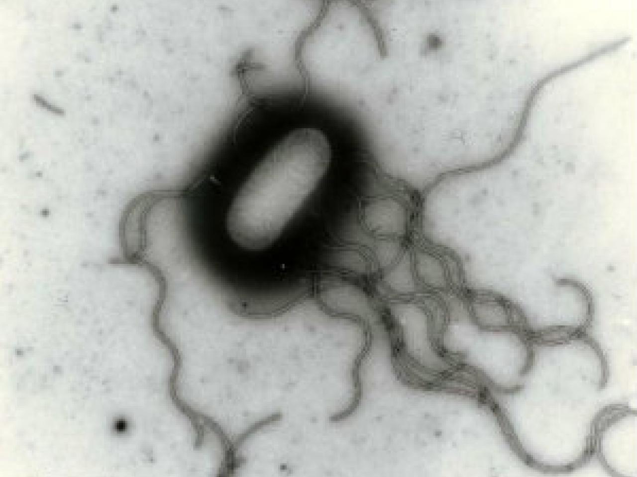 A transmission electron microscope (TEM) image showing what appears to be a bacterial cell with multiple flagella. The image is in black and white, with the bacterium appearing as a dark oval shape against a lighter background. Multiple wavy, thread-like flagella extend from the bacterial cell body in various directions, giving it a characteristic whip-like appearance. The image has a grainy texture typical of TEM microscopy.