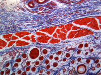 Light Microscopy - Trichrome